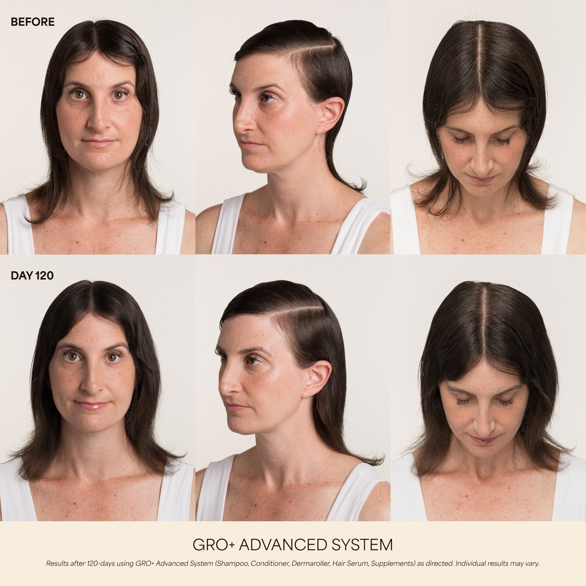 GRO+ Advanced — Dermaroller Stimulant