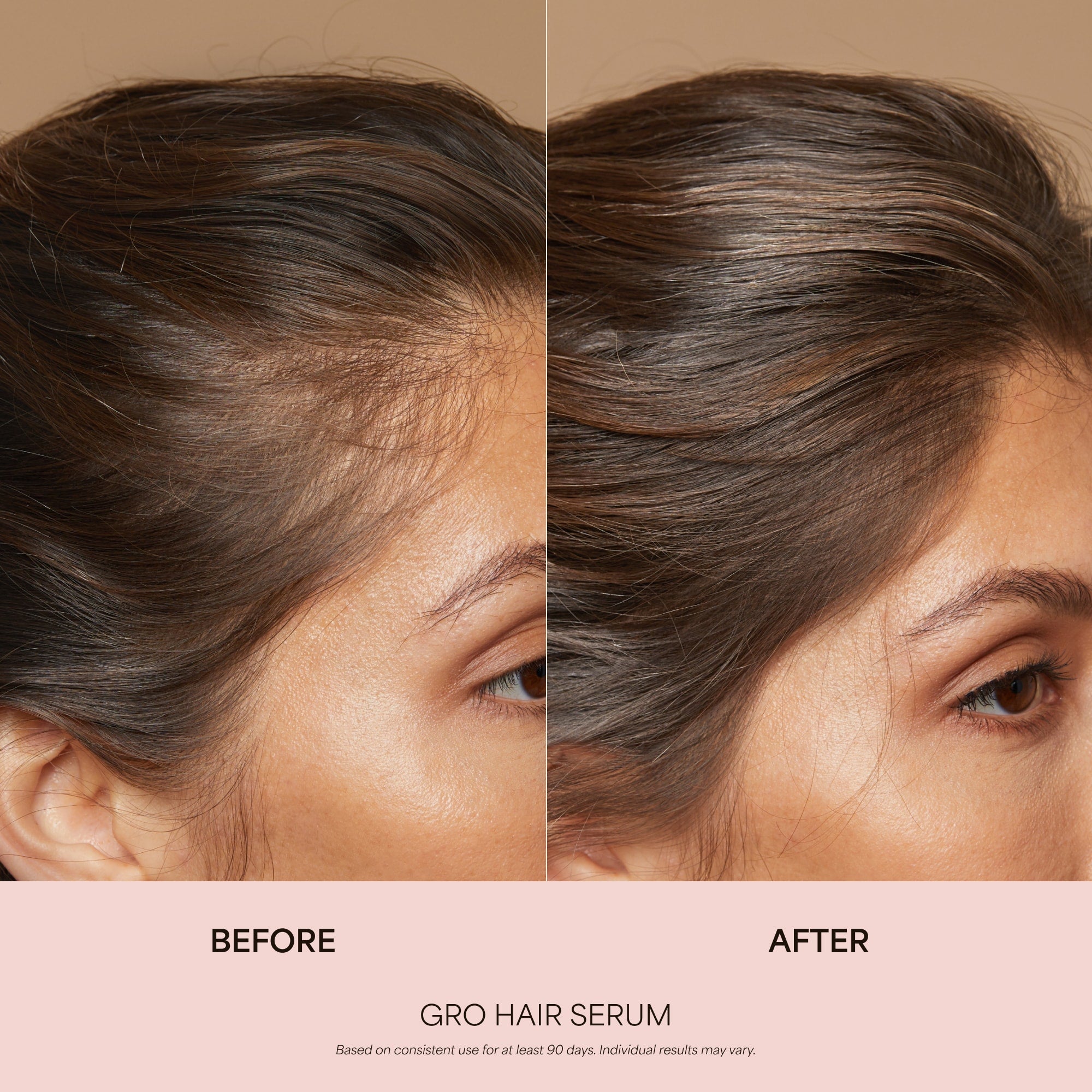 Sérum GRO pour la croissance des cheveux