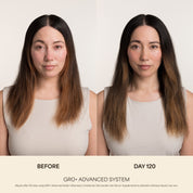 GRO+ Avancé — Après-shampooing Équilibrant & Réparateur