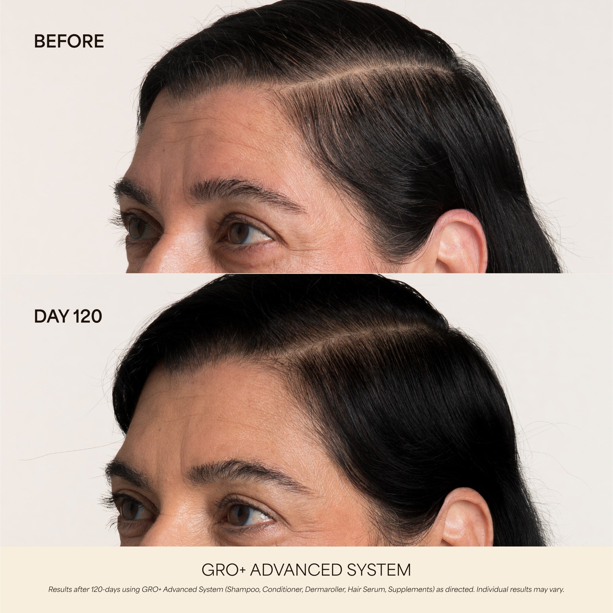 GRO+ Advanced — Dermaroller Stimulant