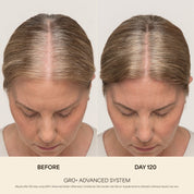 GRO+ Advanced — Sérum Croissance & Densité