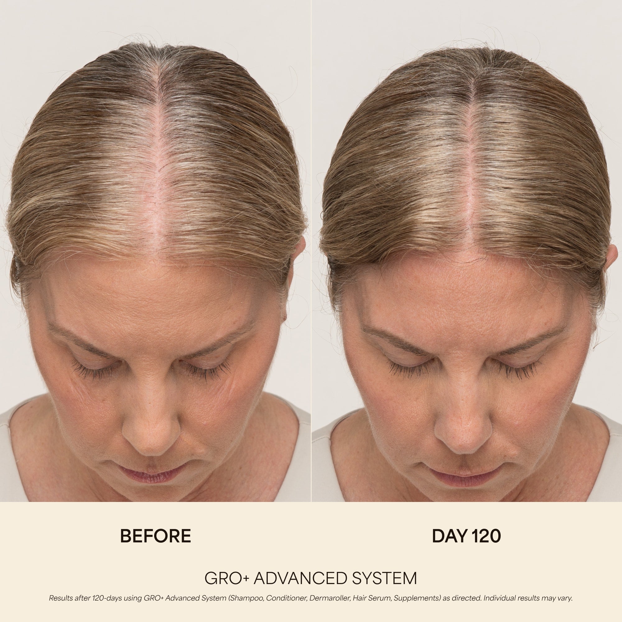 GRO+ Advanced — Sérum Croissance & Densité