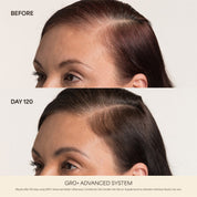 GRO+ Advanced — Sérum Croissance & Densité
